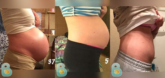 92-Kayla-M-Bellefit-Results-Before-and-After-Bellefit-SLIDE