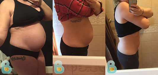 95-Kiera-L-Bellefit-Results-Before-and-After-Bellefit-SLIDE
