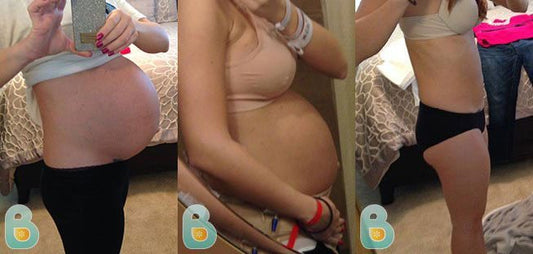 97-Kimberly-D-Bellefit-Results-Before-and-After-Bellefit-SLIDE