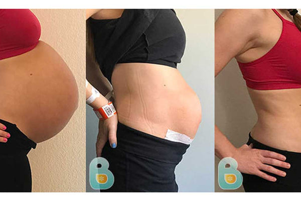 C Section Recovery Band Helps Mom Eliminate Pain & Gain Confidence