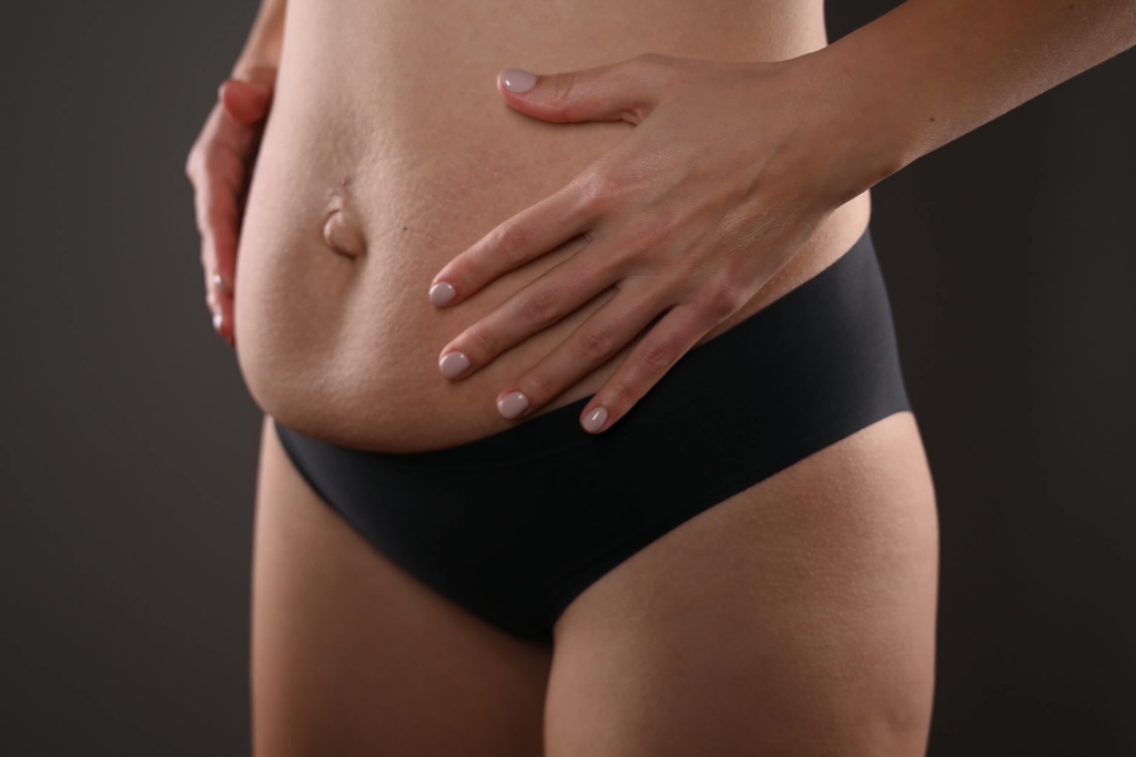 Ab Separation Causes and How To Treat It - Bellefit Postpartum Girdles