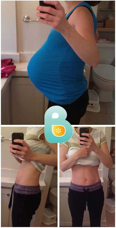 After Being Frustrated by the Way My Belly Looked from Having Twins, I Found Bellefit Online