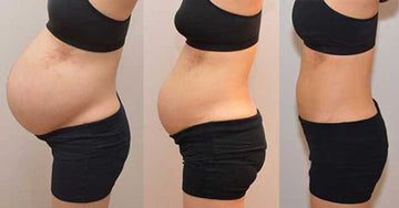 mommy-tummy-advice-post-pregnancy-before-and-after