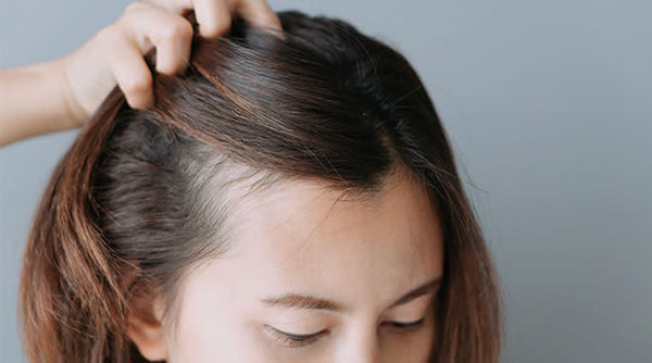 Mane Matters: Navigating the Reality of Postpartum Hair Loss