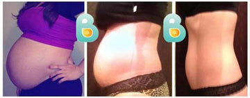second-time-mom-flattens-her-postpartum-tummy-in-three-weeks-linda-a-before-and-after-results