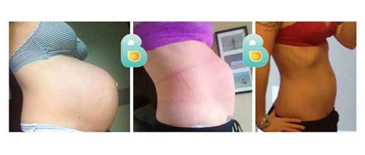 second-time-mom-reclaims-her-body-shape-with-bellefit-i-would-and-have-absolutely-recommended-this-to-everyone-elizabeht-k-results-large-image