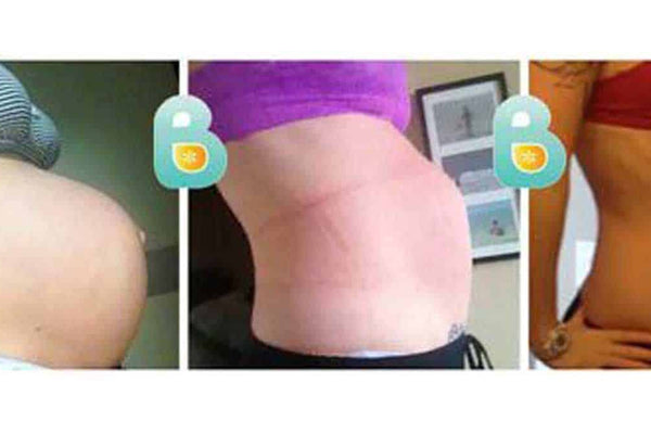 Second time mom reclaims her body shape with Bellefit. "I would and HAVE absolutely recommended this to everyone."